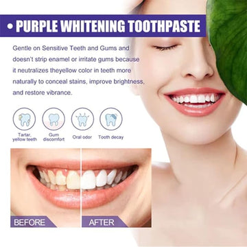 Purple Whitening Toothpaste         معجون تبييض الأسنان باللون الأرجواني