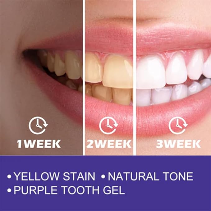 Purple Whitening Toothpaste         معجون تبييض الأسنان باللون الأرجواني